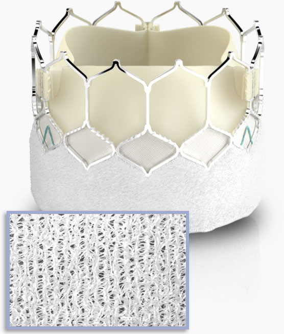 Sealing skirt technology Edwards SAPIEN 3 Ultra valve with a close up showing the textured fabric of the sealing skirt technology