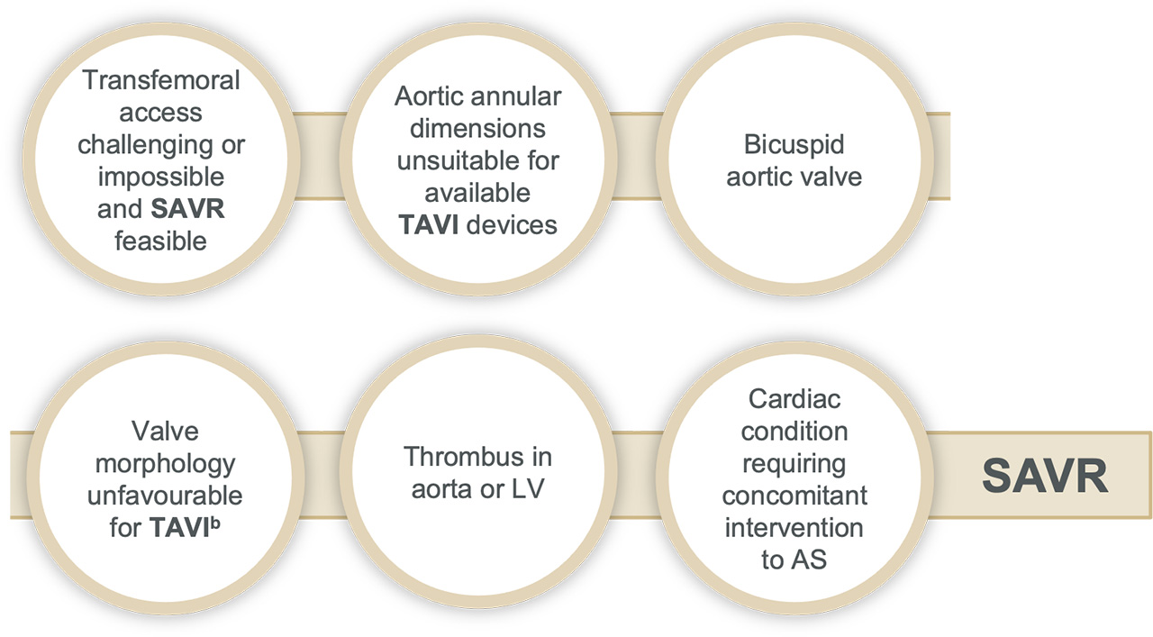 After patients have been referred on age — surgical risk, anatomical and procedural factors, comorbidities and frailty need to be assessed Graphic showing when TAVI may be favourable, and when surgery may be favourable