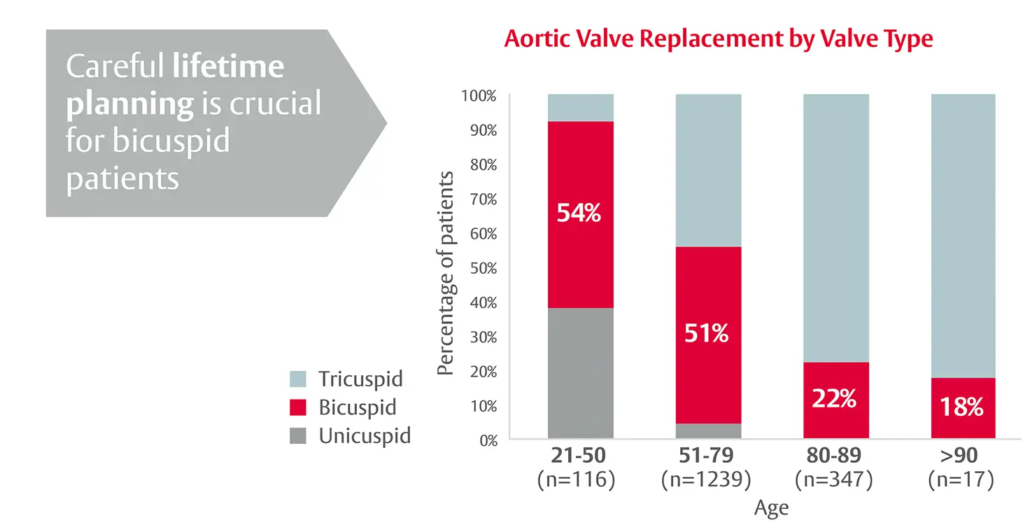 Congenital bicuspid aortic valve disease is more prevalent in younger patients requiring AVR Infographic. Left: arrow label 'TAVI value and optimisation' with the text 'planning is crucial for bicuspid patients.' Right: 100% stacked bar chart titled 'Aortic Valve Replacement by Valve Type.' Y-axis label: 'Percentage of patients' (0–100%). X-axis label: 'Age' with groups: '21–50 (n=116)', '51–79 (n=1239)', '80–89 (n=347)', '>90 (n=17)'. Legend: 'Tricuspid' (light gray), 'Bicuspid' (red), 'Unicuspid' (dark gray). Values printed in the bars: '54%' bicuspid for ages 21–50, '51%' bicuspid for 51–79, '22%' bicuspid for 80–89, and '18%' bicuspid for >90.