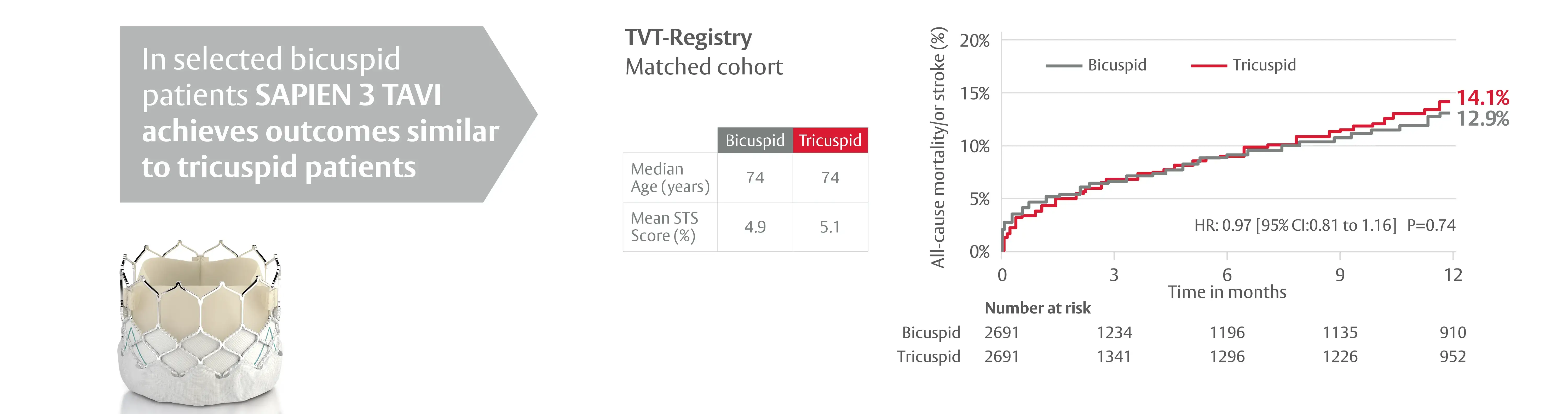 Infographic comparing outcomes for bicuspid vs tricuspid patients treated with SAPIEN 3 TAVI. Left gray arrow text: 'In selected bicuspid patients SAPIEN 3 TAVI achieves outcomes similar to tricuspid patients' above a photo of the SAPIEN 3 valve. Right: 'TVT-Registry — Matched cohort' table with columns Bicuspid and Tricuspid: 'Median Age (years) 74 vs 74'; 'Mean STS Score (%) 4.9 vs 5.1'. Kaplan–Meier chart with legend (gray=Bicuspid, red=Tricuspid), y-axis 'All-cause mortality or stroke (%)', x-axis 'Time in months'. Twelve-month rates: Tricuspid 14.1%, Bicuspid 12.9%. Statistics: 'HR: 0.97 [95% CI: 0.81 to 1.16] P=0.74'. Number at risk (months 0, 3, 6, 9, 12): Bicuspid 2691, 1234, 1196, 1135, 910; Tricuspid 2691, 1341, 1296, 1226, 952.