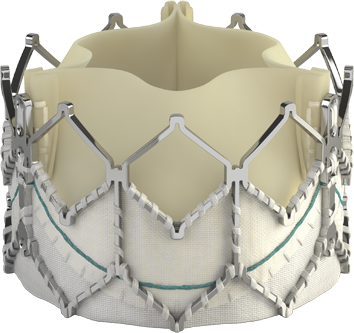 Edwards SAPIEN XT valve