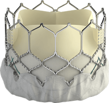 Edwards SAPIEN 3 valve