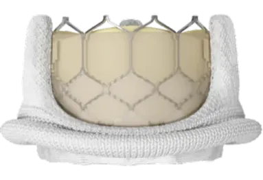 Image of valve