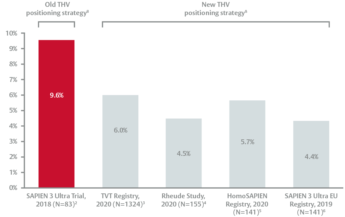 Bar chart showing Edwards SAPIEN 3 Ultra valve permanent pacemaker rates